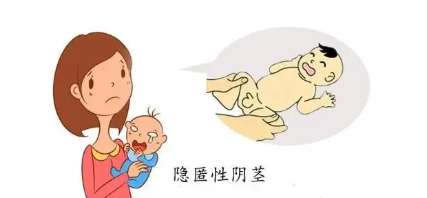 如何区分隐匿性阴茎和包茎1,看:将阴茎想象成1支削过的铅笔,那么有