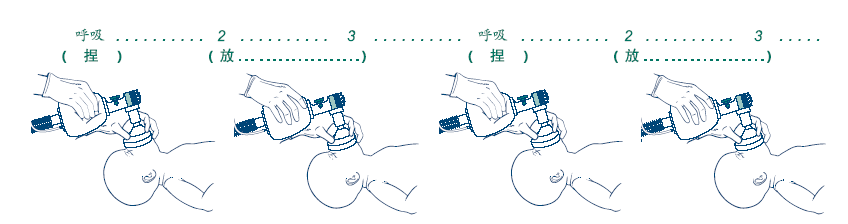 通气步骤3,矫正通气步骤操作顺序:m:调整面罩:面颊和鼻梁部最易漏气r