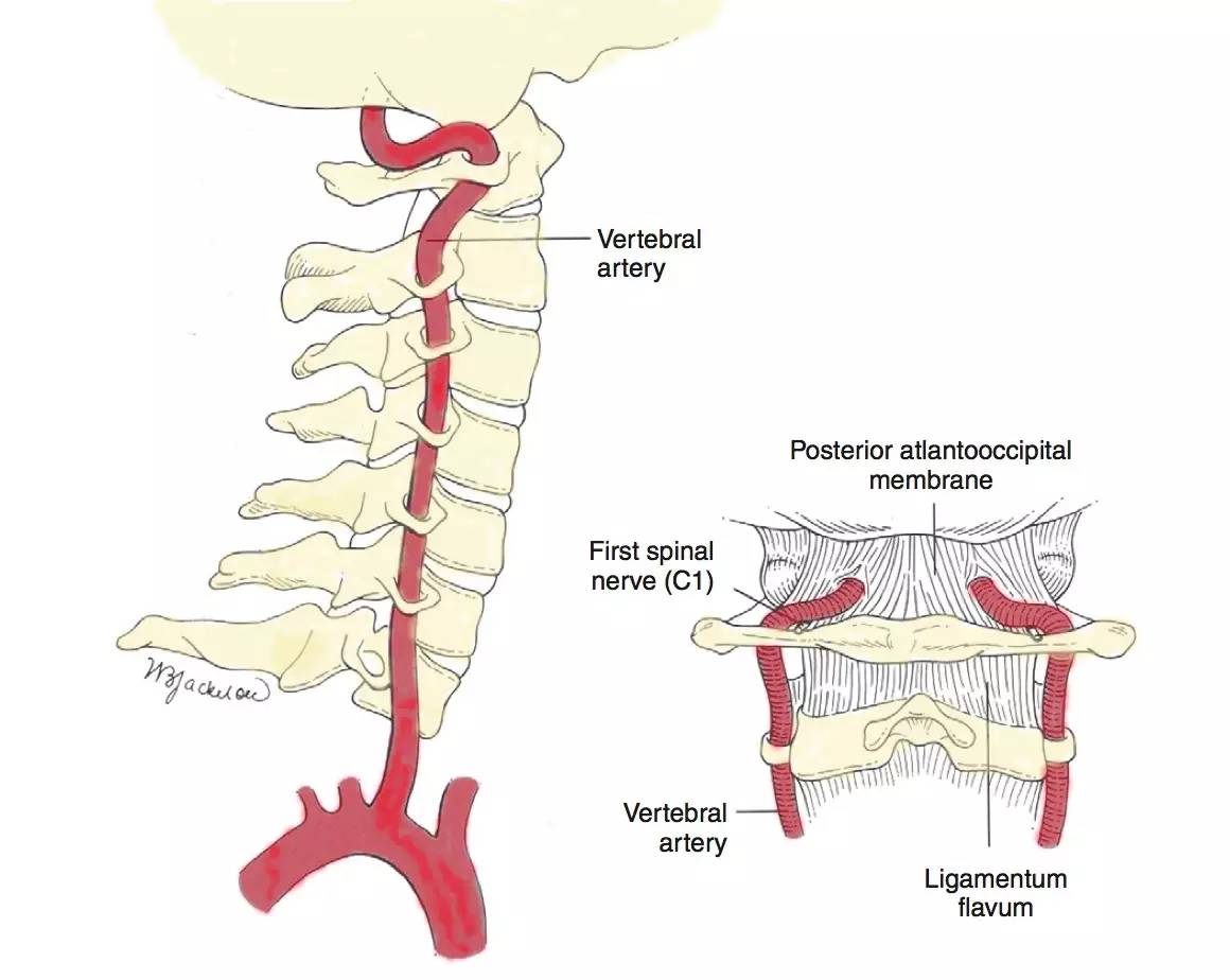 椎动脉沟环位置图片图片