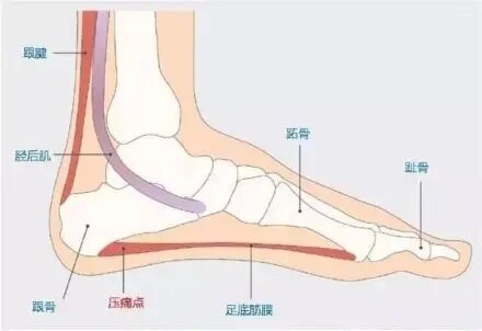 脚后跟疼痛图解图片