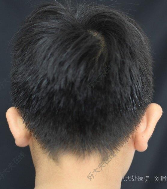 圖文圖片