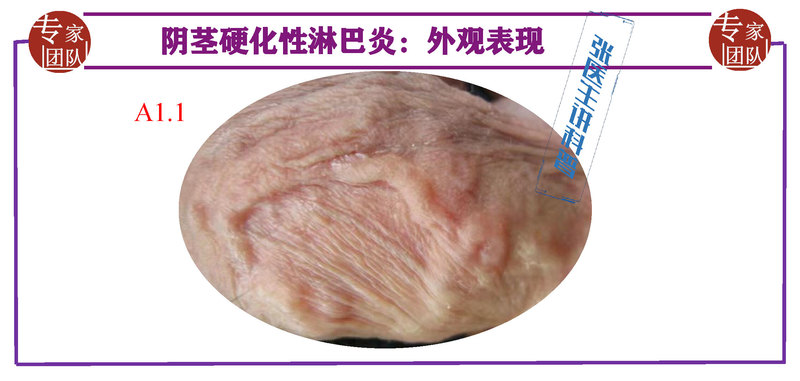 圖文圖片