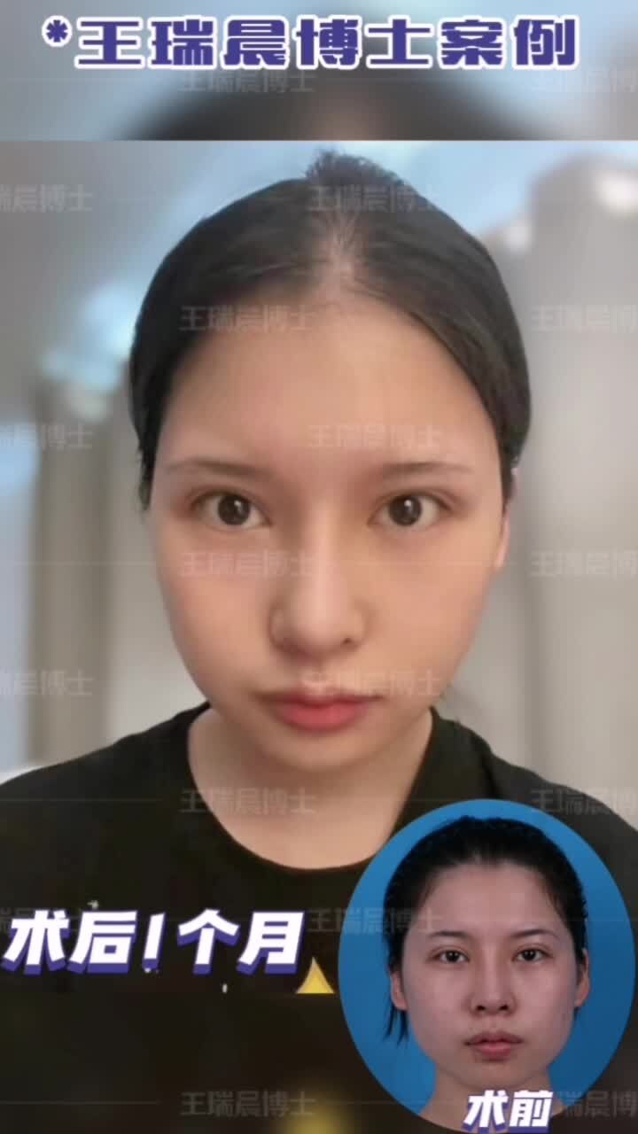 視頻封面