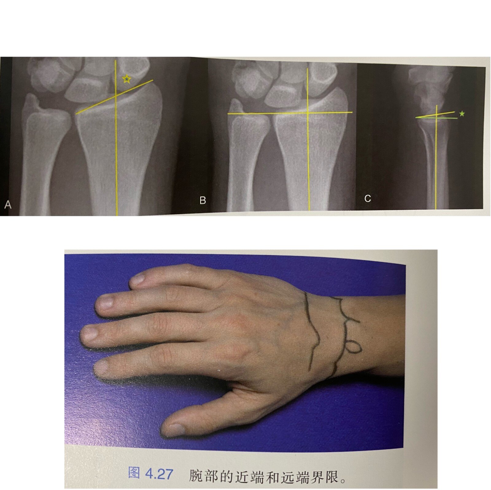 手外科康復-手和腕關節解剖概述-腕關節-骨骼和關節 - 好大夫在線