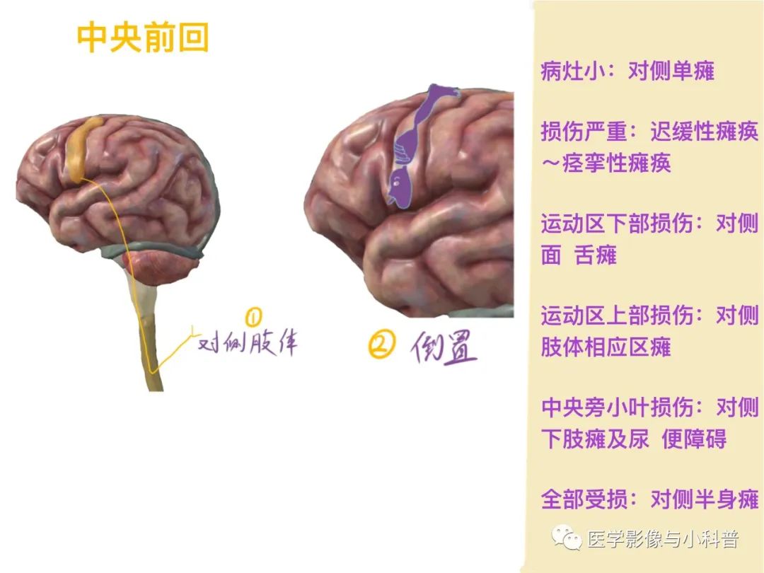 神经定位诊断:解剖+影像+临床_脑外伤_症状表现_检查 - 好大夫在线
