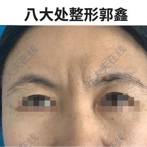 圖文圖片