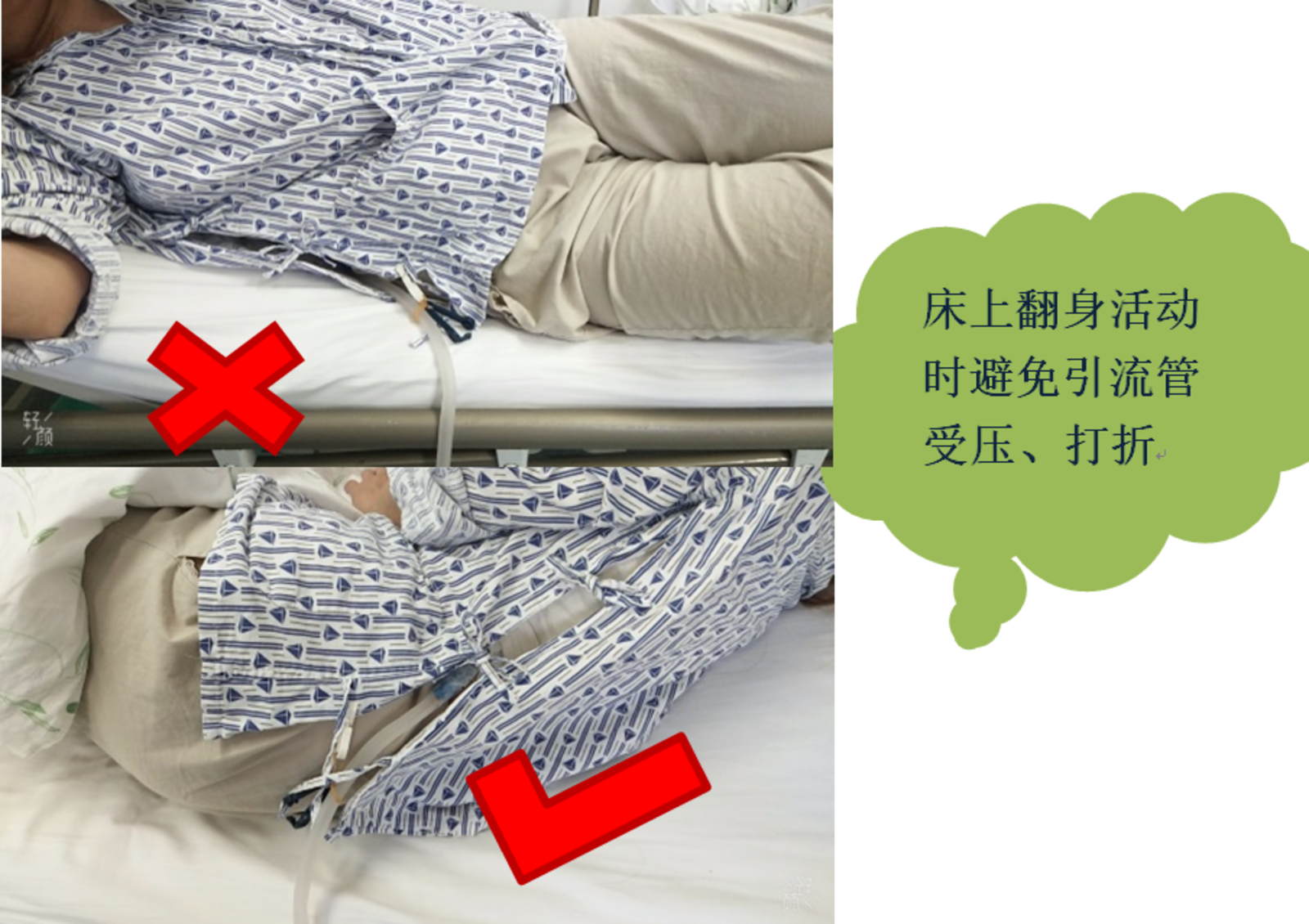 一次性颅脑外引流收集装置（Ⅱ型）-上海库欣医疗科技有限公司
