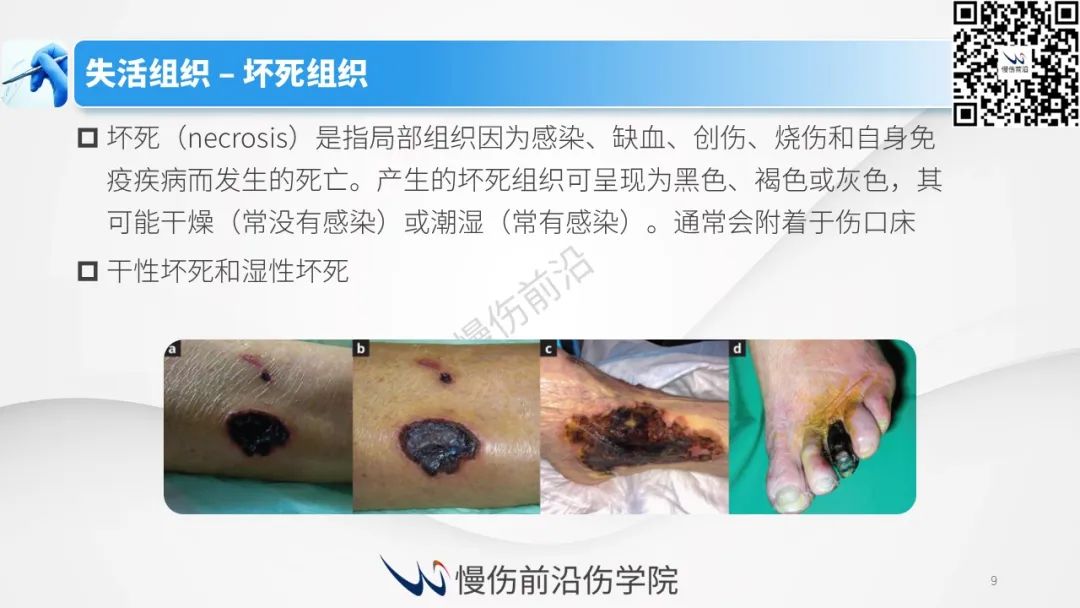 伤口清创最佳实践国际共识 - 好大夫在线