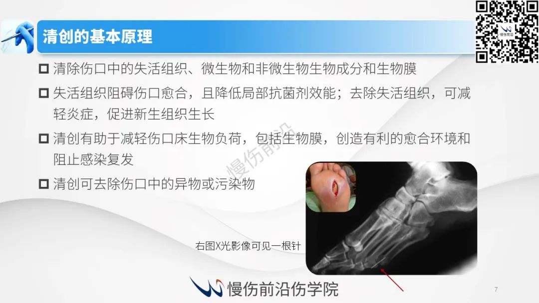 伤口清创最佳实践国际共识 - 好大夫在线