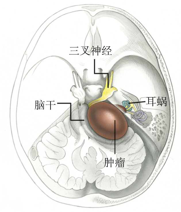 听神经位置图片图片