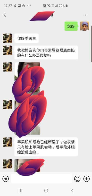 圖文圖片