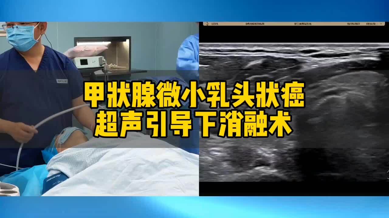 視頻封面