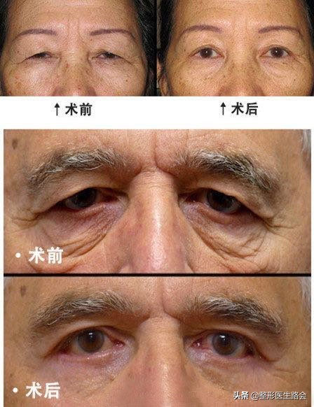 圖文圖片