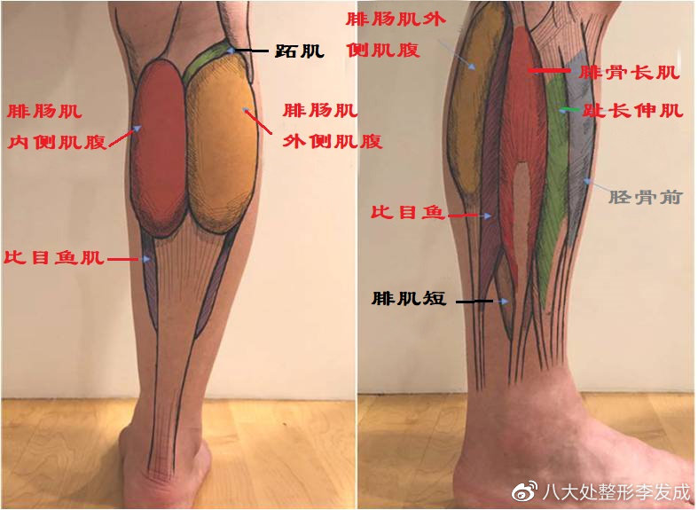 关于肉毒素瘦小腿的最全科普