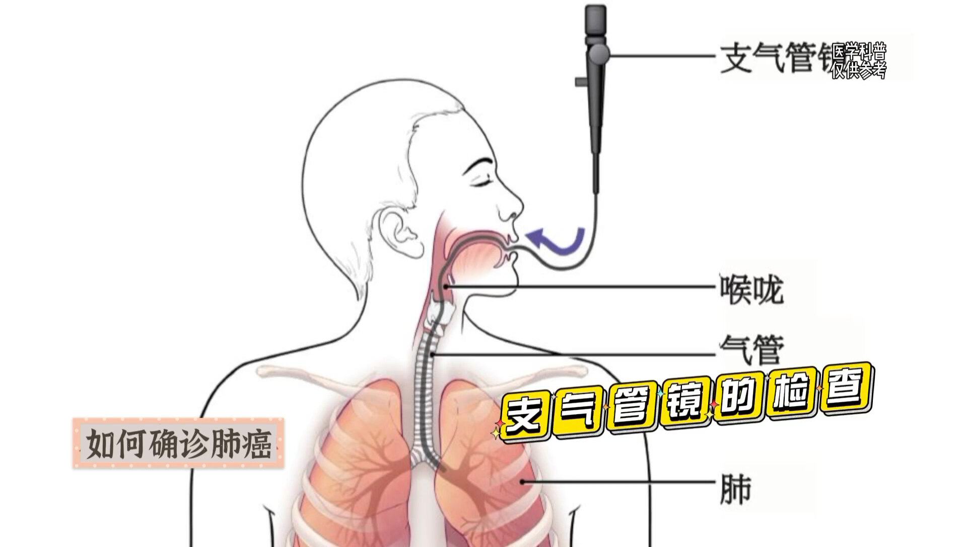 默认图片