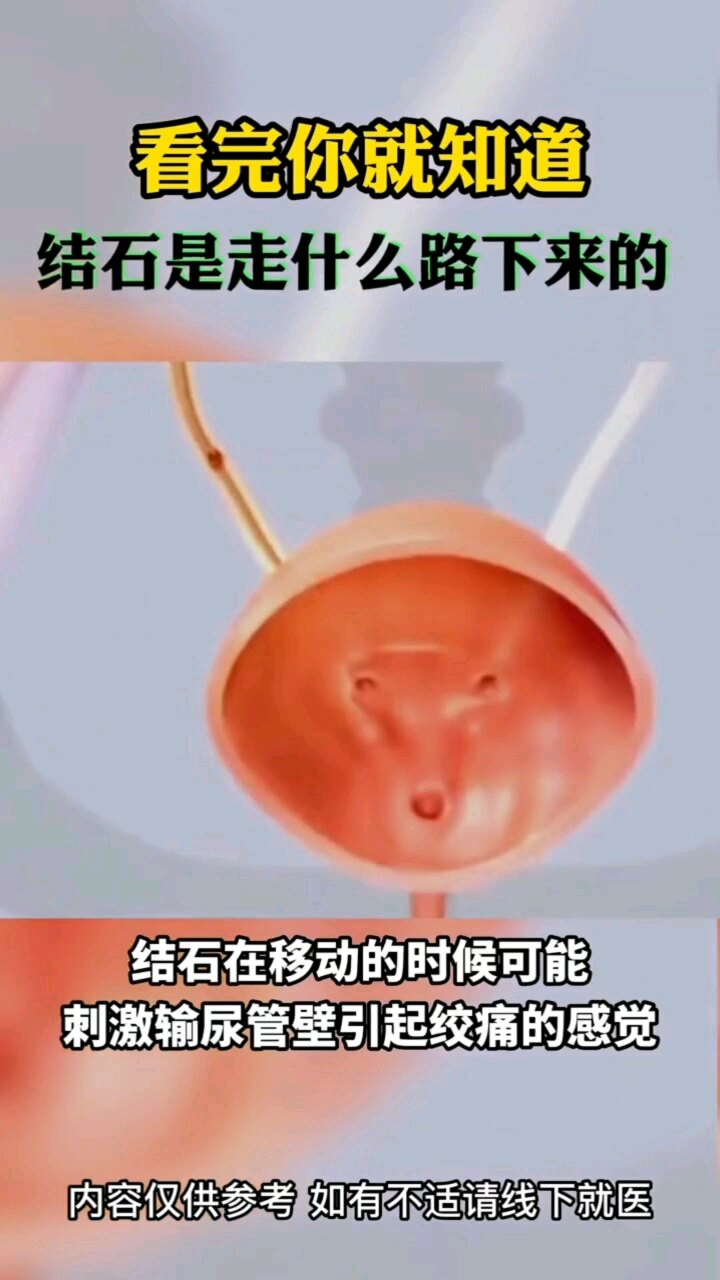 默认图片