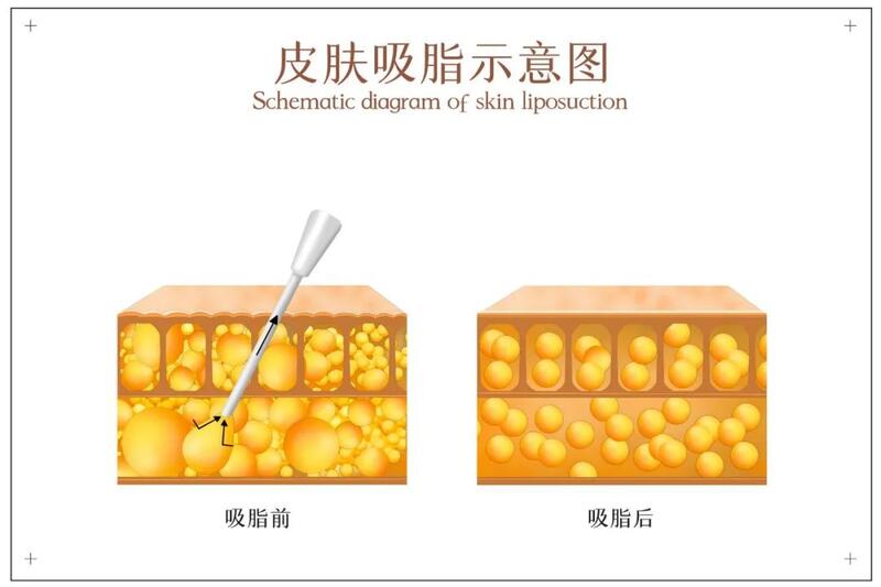 圖文圖片