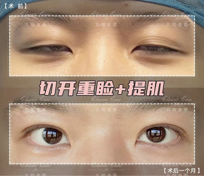圖文圖片