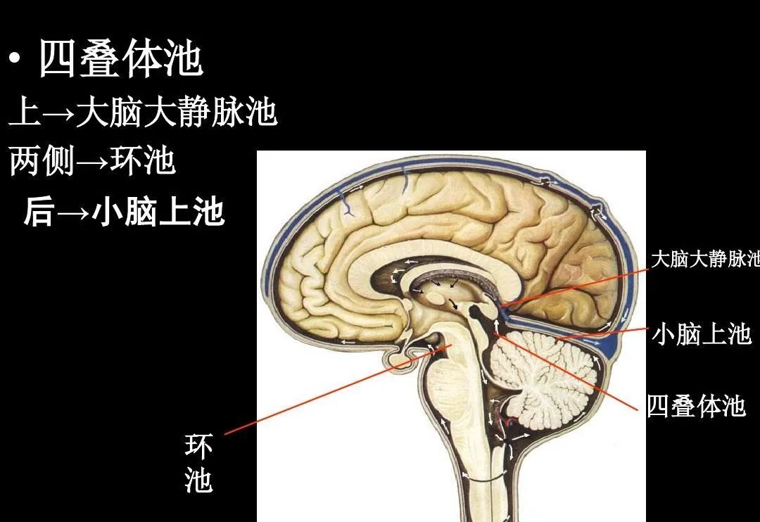 小脑上池解剖图图片