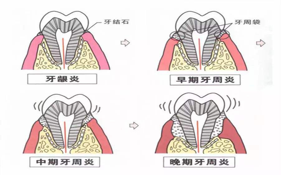 牙龈解剖图图片