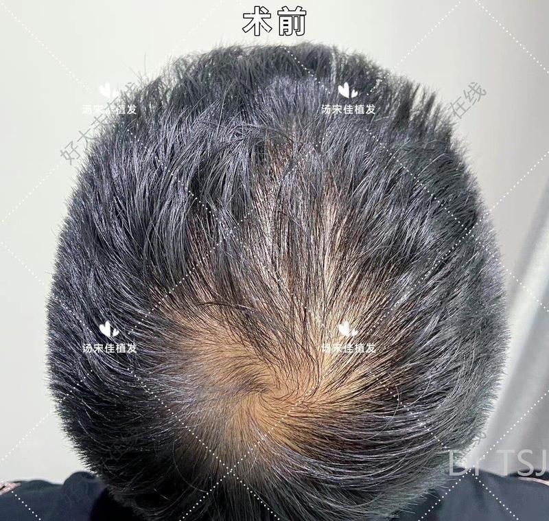 圖文圖片