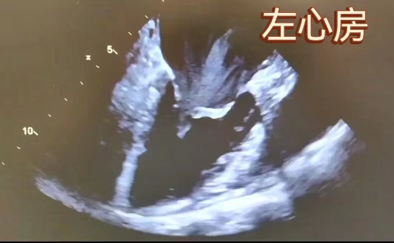 圖文圖片