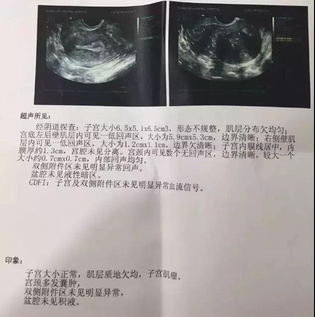 圖文圖片