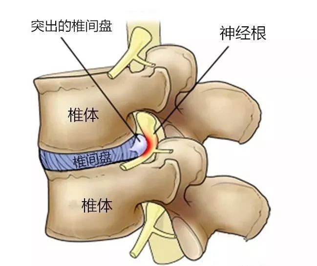 人体腰椎示意图位置图片