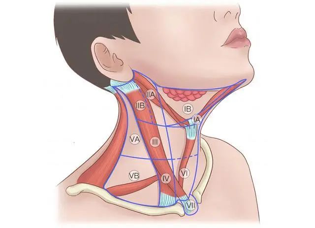 甲状腺区域六区图图片