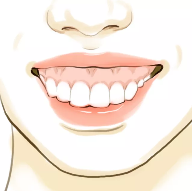 龅牙露牙龈.png