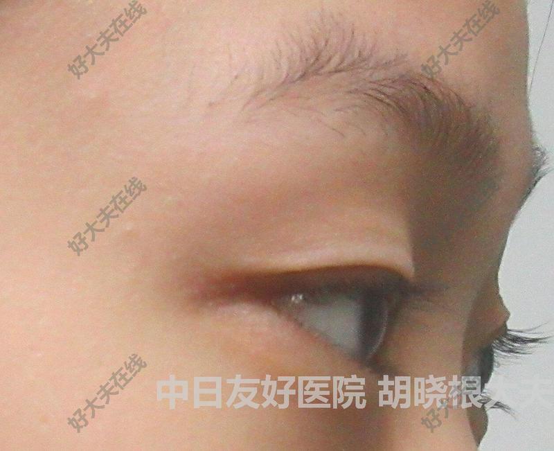 圖文圖片