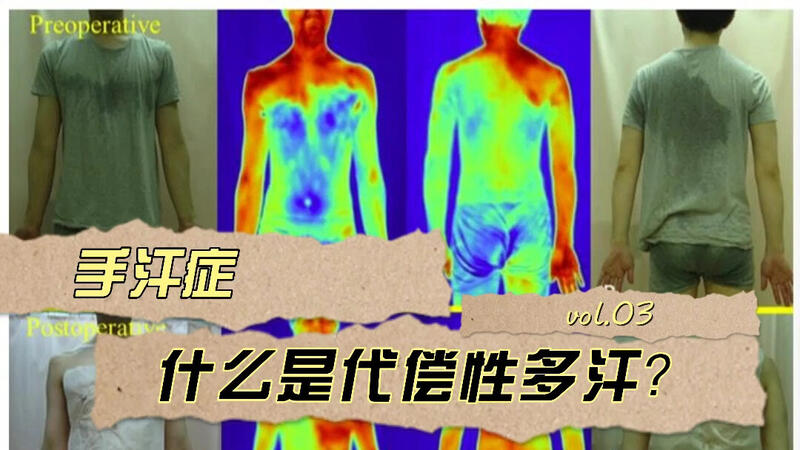 視頻封面