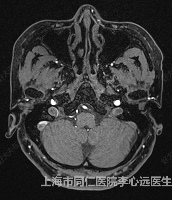 圖文圖片