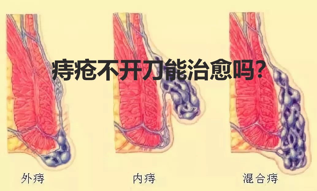圖文圖片