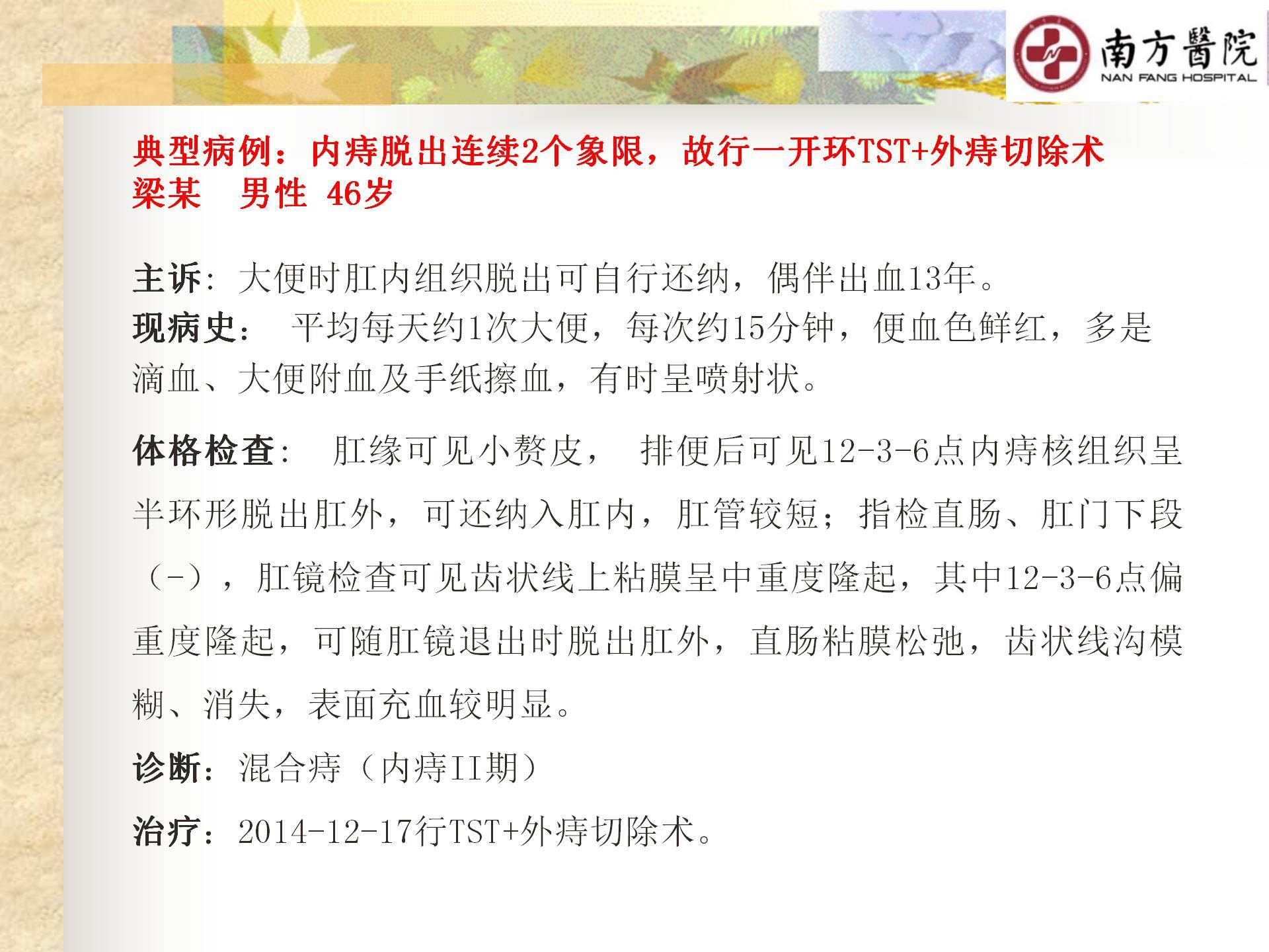 痔的精准化规范化微创化治疗之痔脱出1_17.jpg