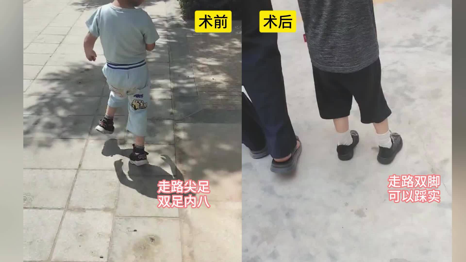視頻封面