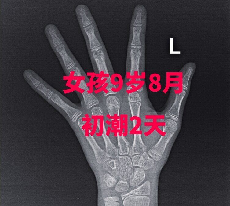 圖文圖片