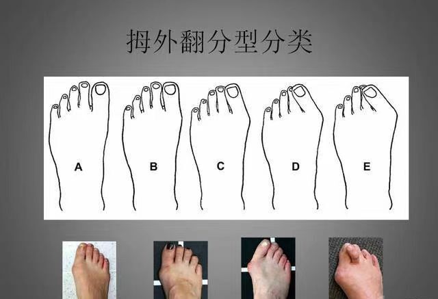 圖文圖片