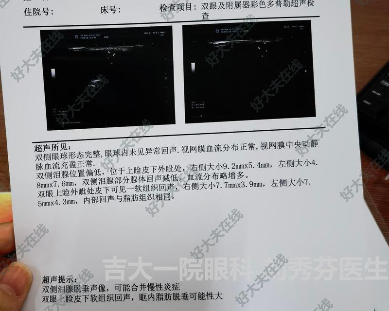 泪腺脱垂_倒睫 - 好大夫在线