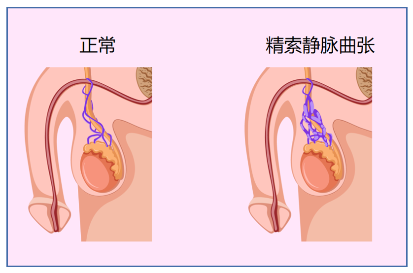 圖文圖片