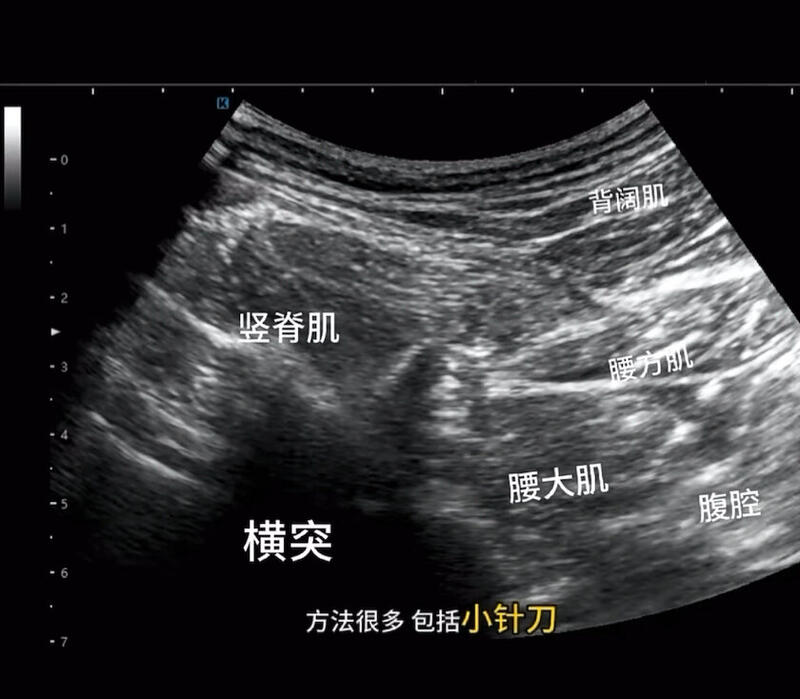 視頻封面