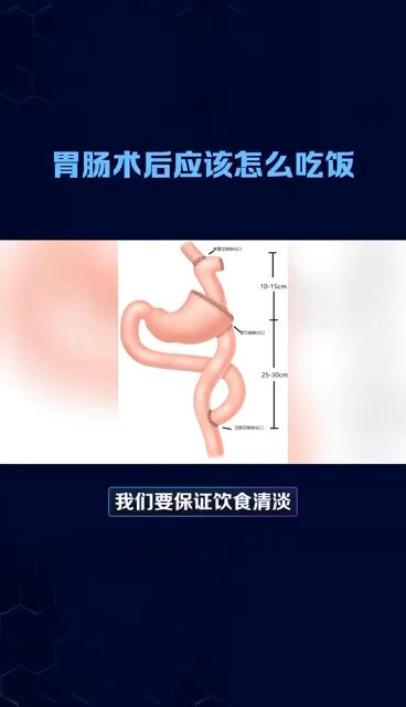 視頻封面