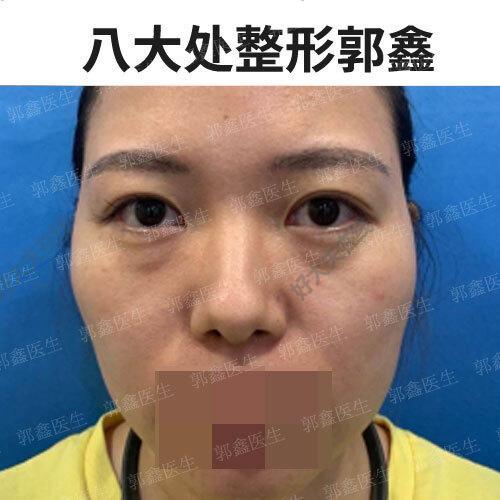 圖文圖片