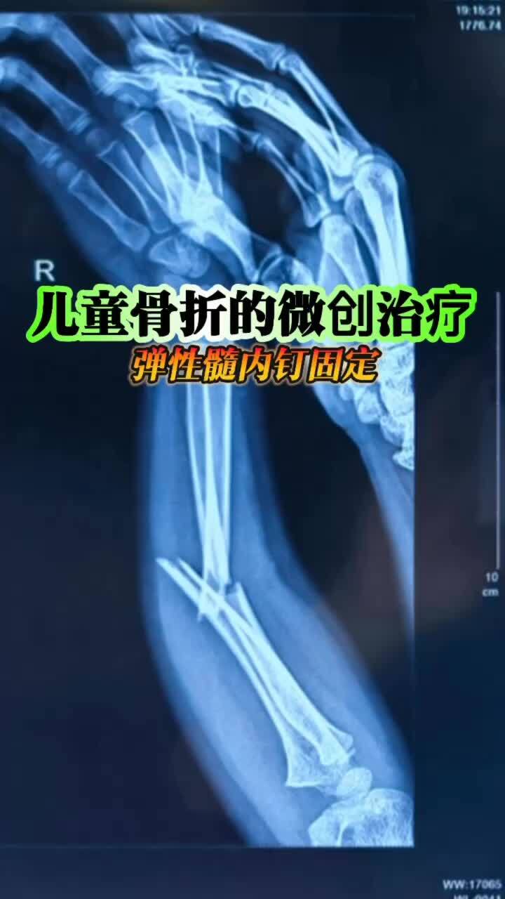 視頻封面