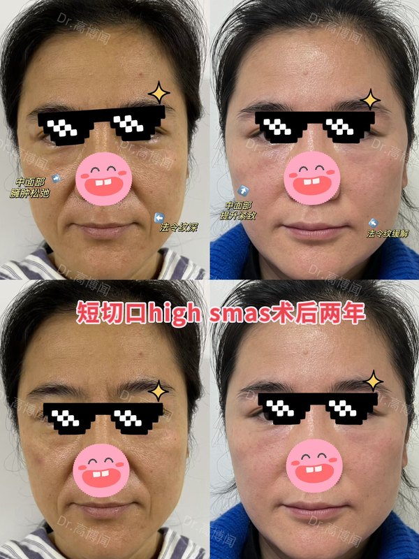 图文图片
