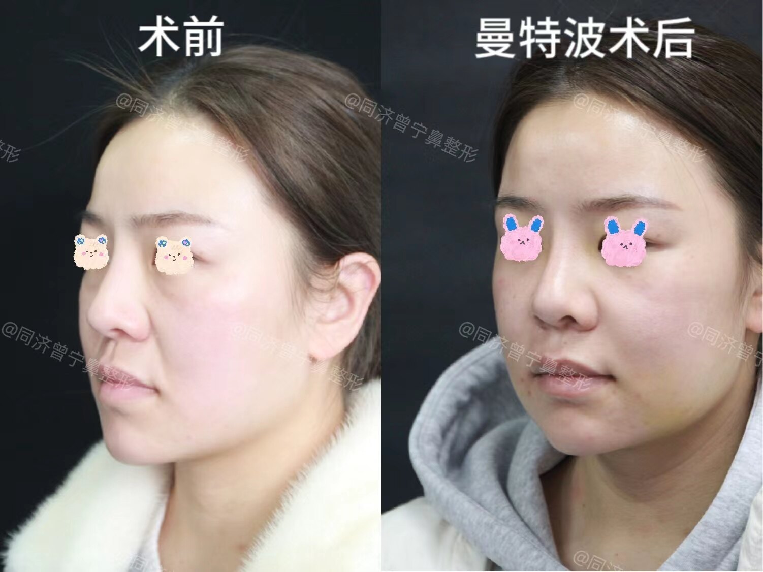 圖文圖片
