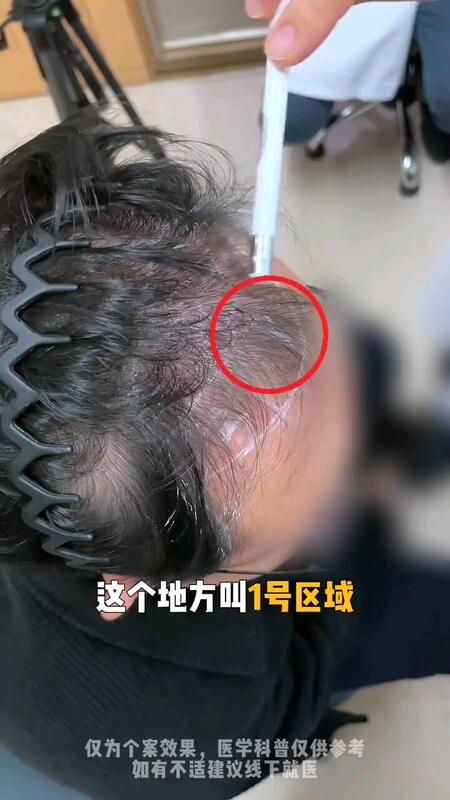 視頻封面
