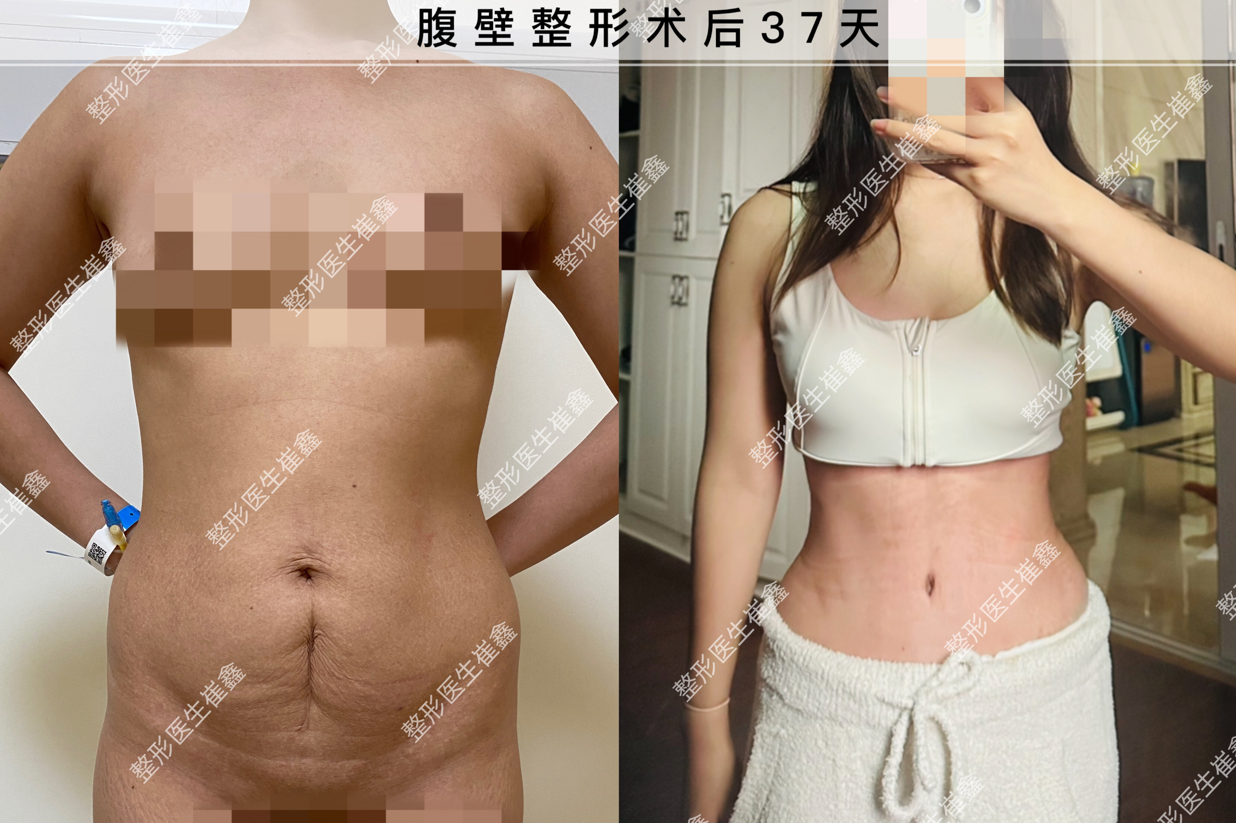 圖文圖片