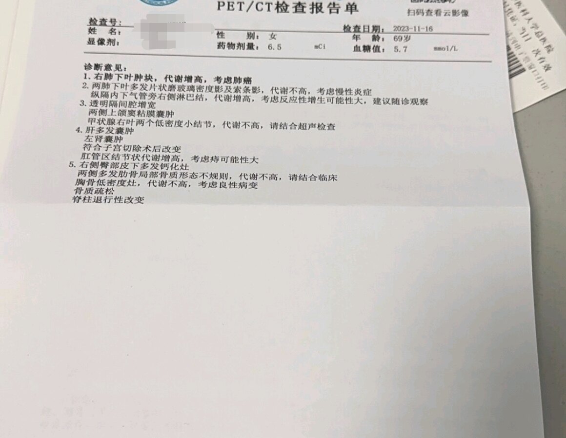 刘懿博士说肺癌（六七七二）PET-CT可初步判断有些肺占位能否手术_肺癌_检查_治疗方式 - 好大夫在线