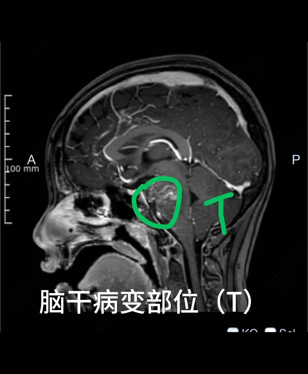 默认图片